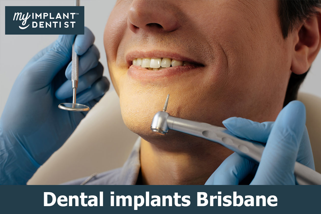Dental Implants Are  Generally Made Of Titanium  And Also Are Placed Into The Jawbone